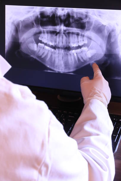 Best Emergency Broken Tooth Repair in South San Francisco, CA